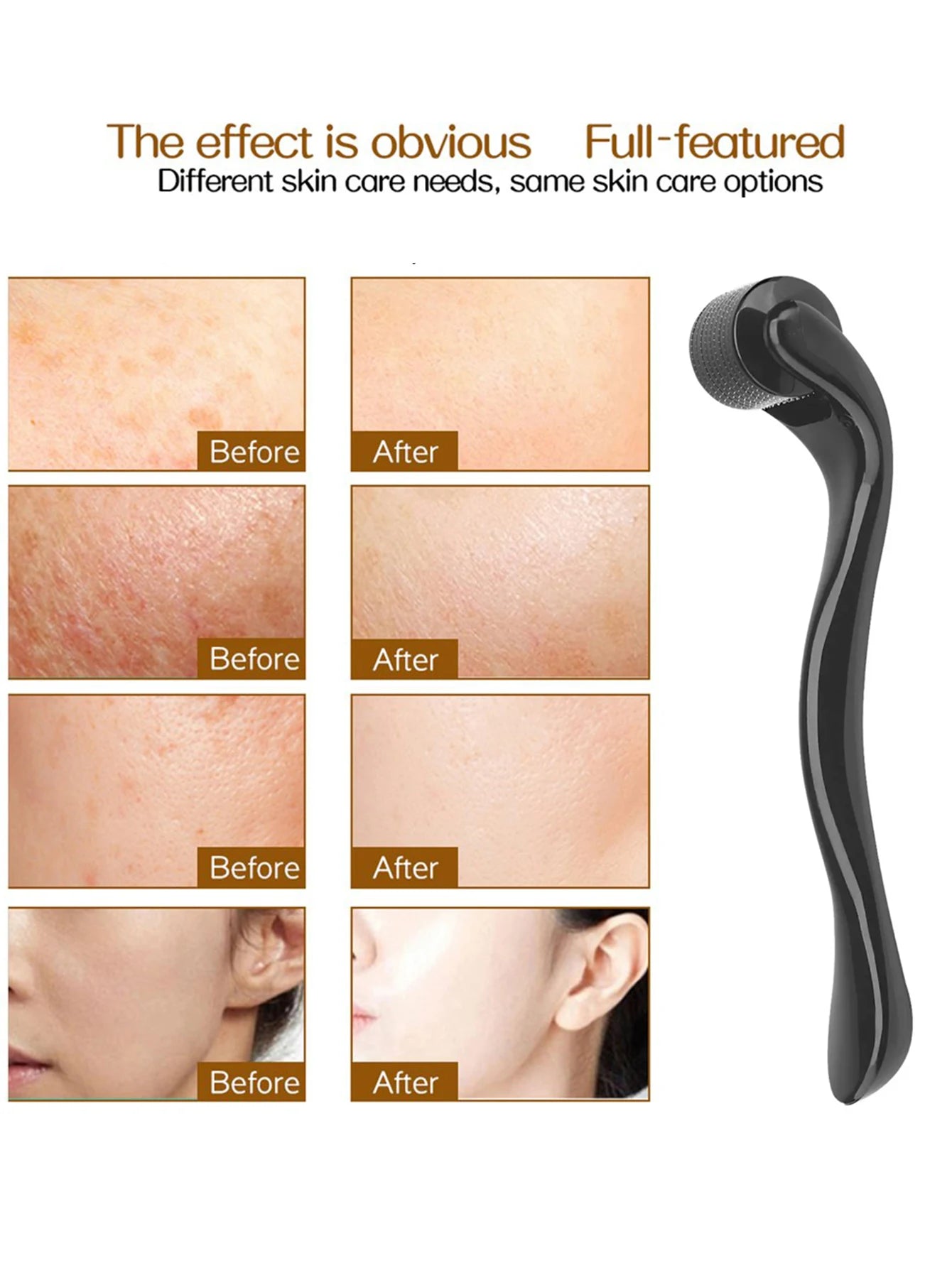 Rodillo Dermaroller 540 Microagujas de Titanio — Cuidado Facial Profesional en Casa