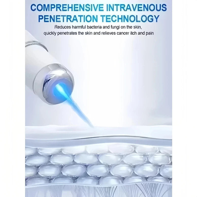 Dispositivo Láser de Luz Azul para Venas | Tratamiento Profesional en Casa