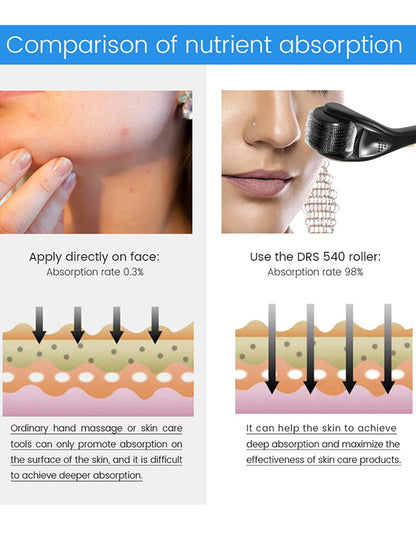 Rodillo Dermaroller 540 Microagujas de Titanio — Cuidado Facial Profesional en Casa