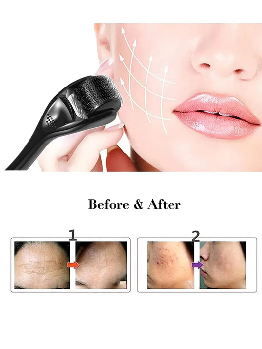 Rodillo Dermaroller 540 Microagujas de Titanio — Cuidado Facial Profesional en Casa